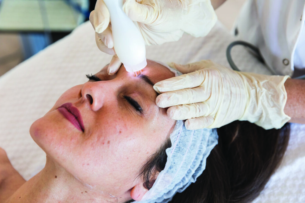 Trattamento viso donna con radiofrequenza frazionata