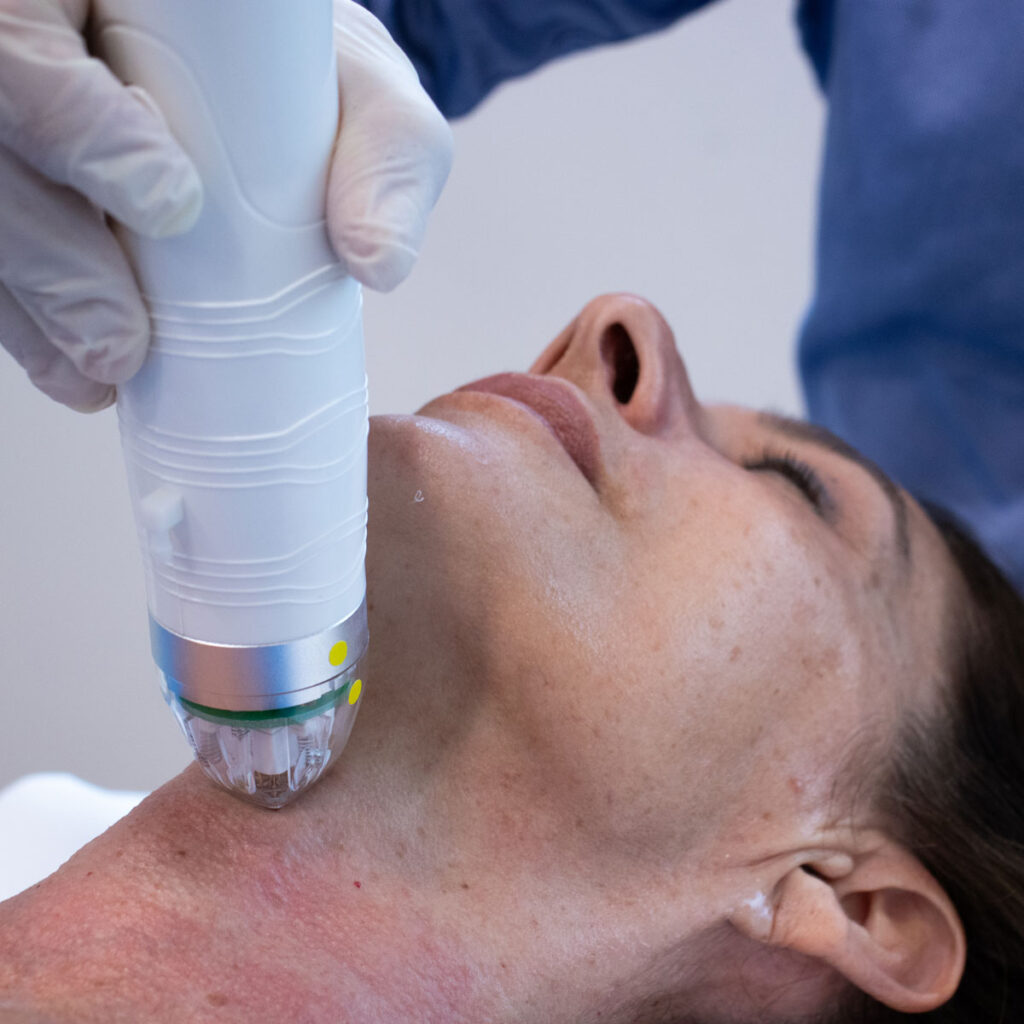 Trattamento viso donna con tecnologia Fr-Action